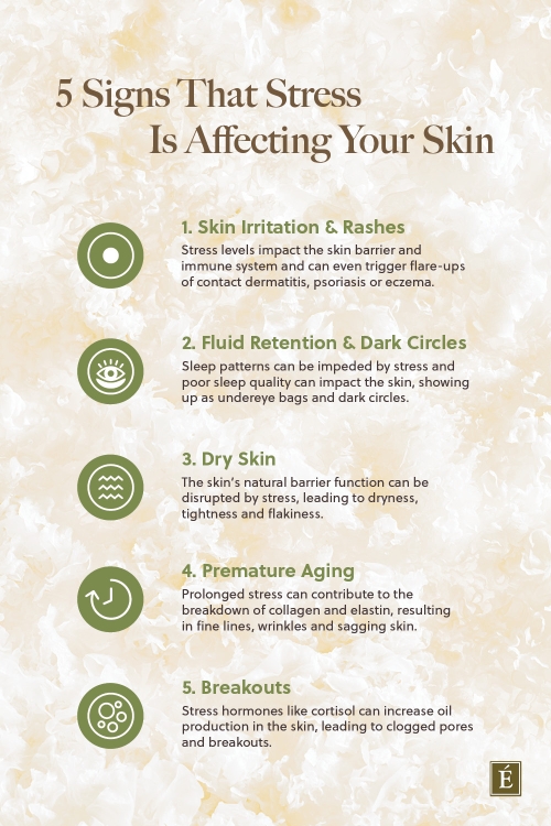 5 signs that stress is affecting your skin